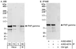 Detection of human and mouse PAP-gamma by western blot (h&amp;m) and immunoprecipitation (h).