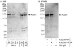 Detection of human and mouse PolA1 by western blot (h&amp;m) and immunoprecipitation (h).