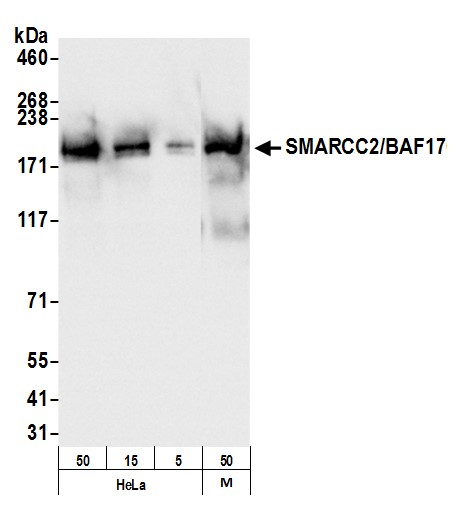 Detection of human and mouse SMARCC2/BAF170 by western blot.