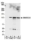 Detection of mouse SMARCA3 by western blot.