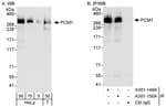 Detection of human PCM1 by western blot and immunoprecipitation.