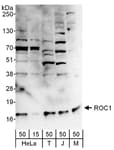Detection of human and mouse ROC1 by western blot.