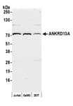Detection of human ANKRD13A by western blot.
