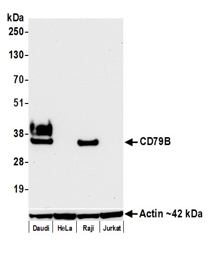 Detection of human CD79B by western blot.