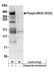 Detection of human Phospho BRCA1 (S1423) by western blot.