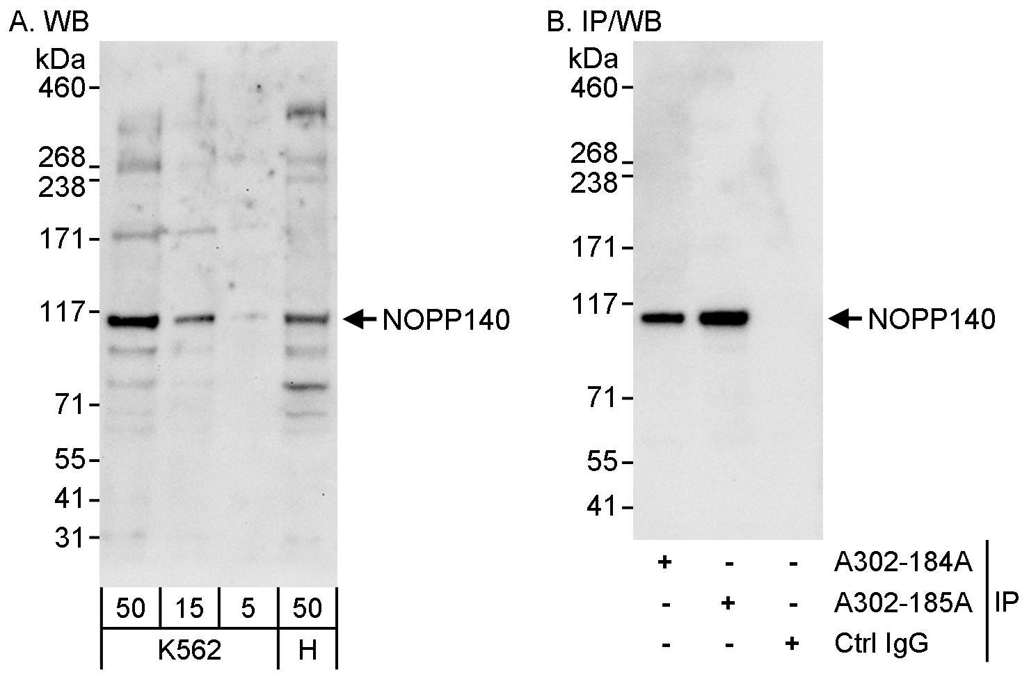 Detection of human NOPP140 by western blot and immunoprecipitation.