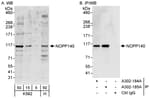 Detection of human NOPP140 by western blot and immunoprecipitation.
