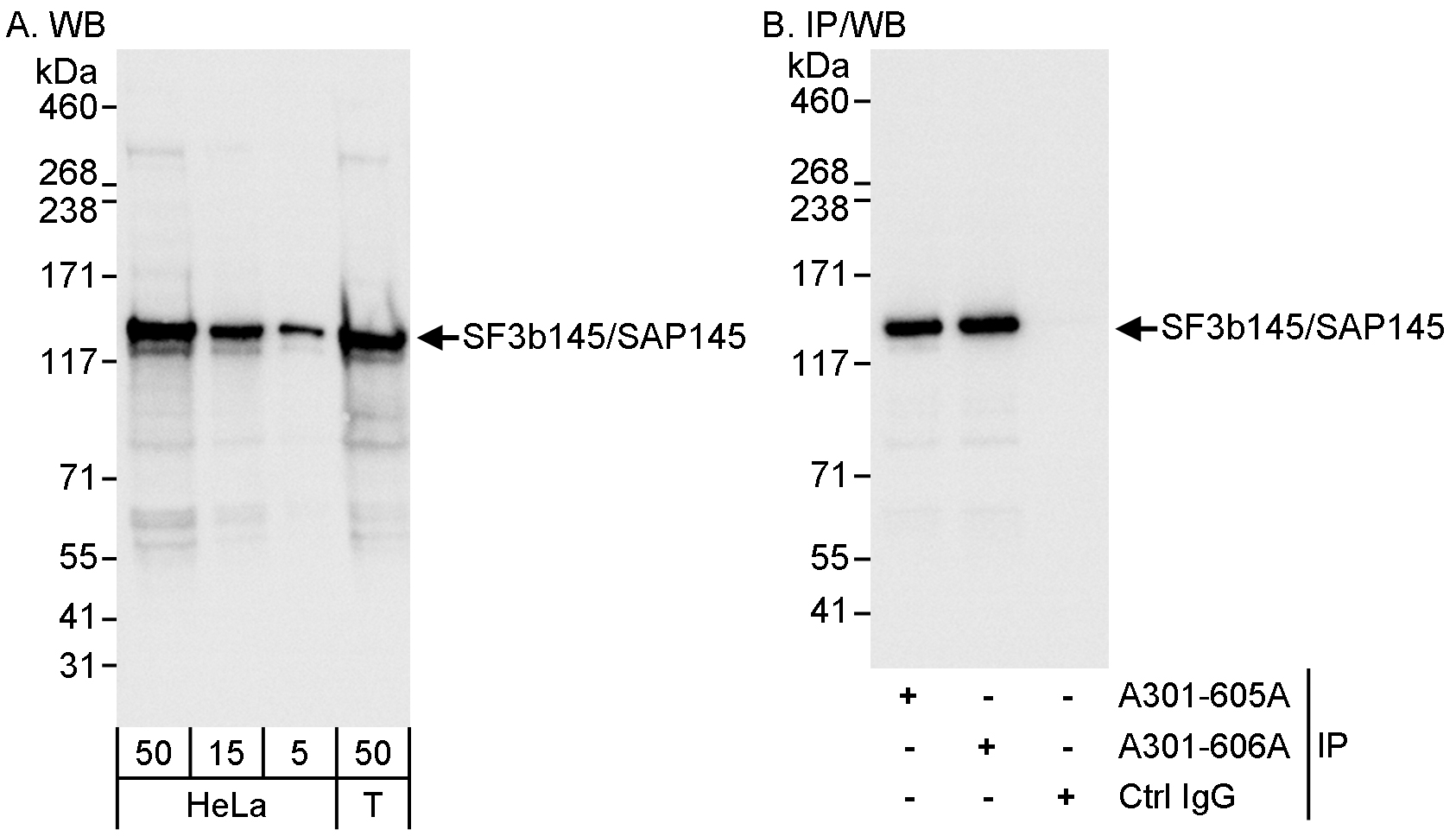 Detection of human SF3b145/SAP145 by western blot and immunoprecipitation.