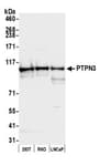 Detection of human PTPN3 by western blot.