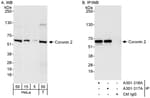 Detection of human Coronin 2 by western blot and immunoprecipitation.