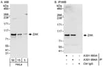 Detection of human ZAK by western blot and immunoprecipitation.
