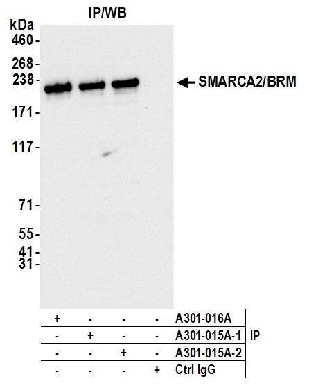 Detection of human SMARCA2/BRM by western blot of immunoprecipitates.