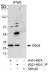 Detection of human ORC6 by western blot of immunoprecipitates.