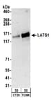 Detection of mouse LATS1 by western blot.