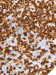 Detection of human CD45R by immunohistochemistry.