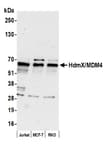 Detection of human HdmX/MDM4 by western blot.