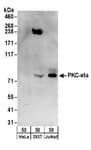 Detection of human PKC-eta by western blot.