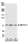 Detection of human METTL13 by western blot.