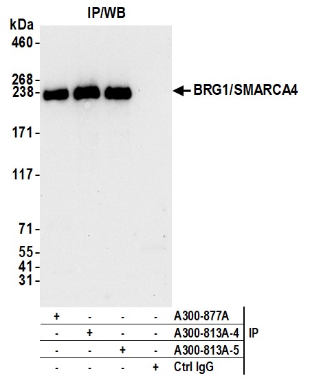 Detection of human BRG1/SMARCA4 by western blot of immunoprecipitates.