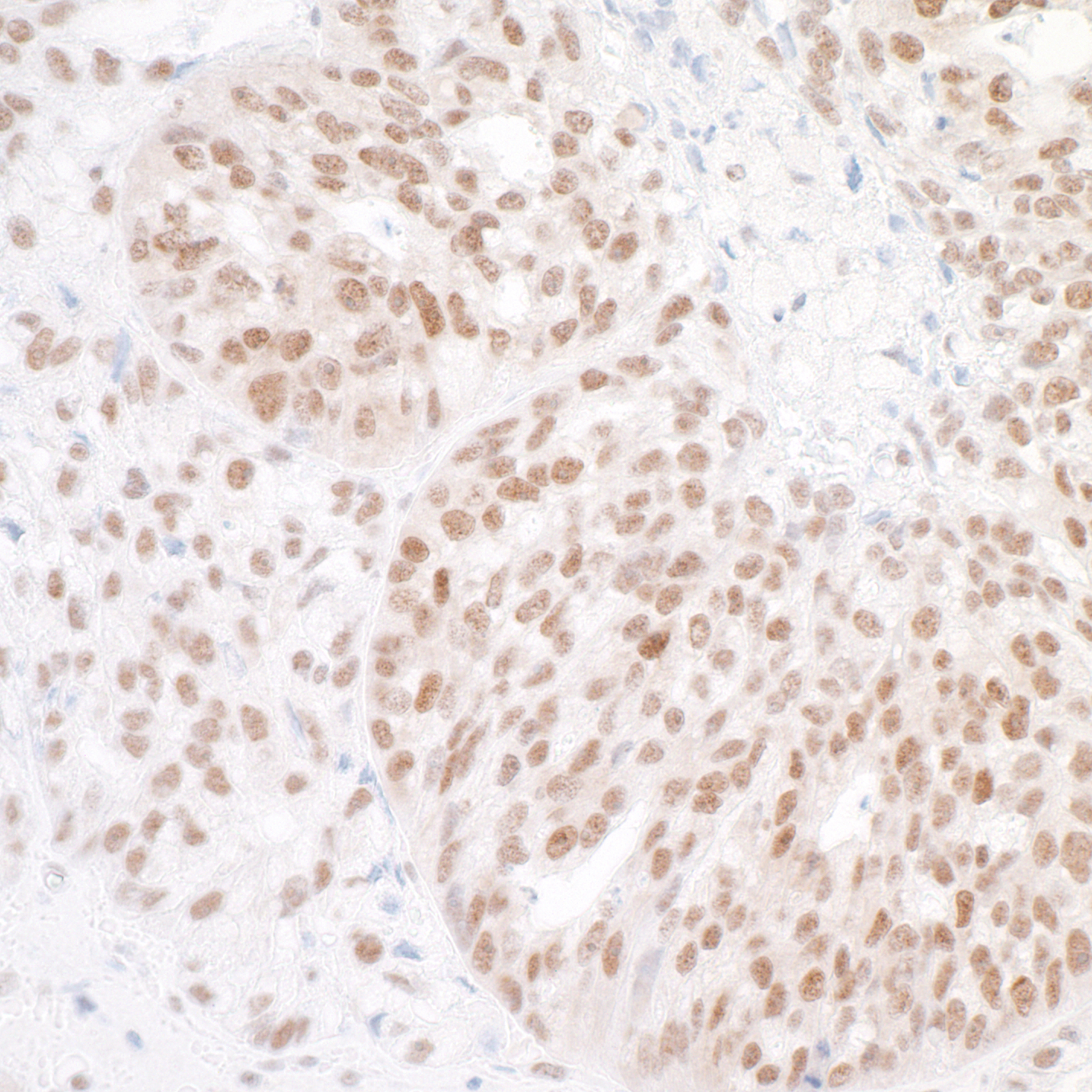 Detection of human BAF53A by immunohistochemistry.