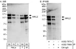 Detection of human and mouse MKL2 by western blot (h&amp;m) and immunoprecipitation (h).