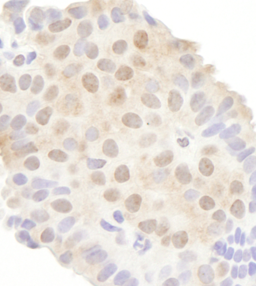 Detection of human DDX20 by immunohistochemistry.