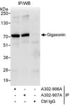 Detection of human Gigaxonin by western blot of immunoprecipitates.