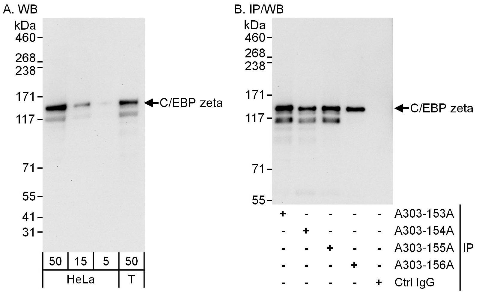Detection of human C/EBP zeta by western blot and immunoprecipitation.
