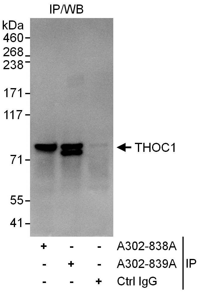 Detection of human THOC1 by western blot of immunoprecipitates.