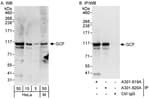 Detection of human and mouse GCF by western blot (h&amp;m) and immunoprecipitation (h).
