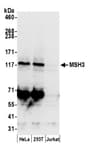 Detection of human MSH3 by western blot.
