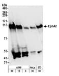 Detection of human and mouse EphA2 by western blot.