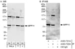 Detection of human MPP11 by western blot and immunoprecipitation.