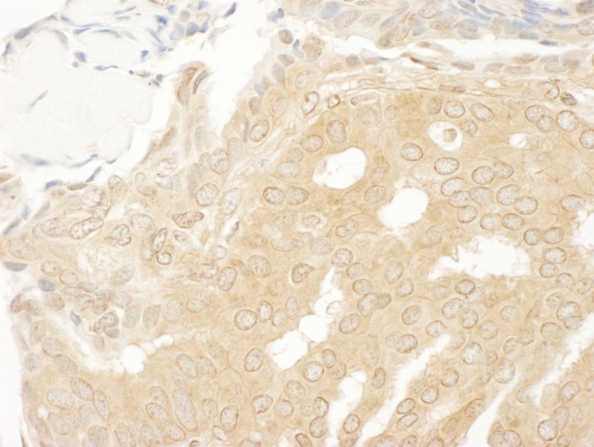 Rabbit anti-MEK2 IHC Antibody