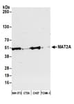 Detection of mouse MAT2A by western blot.