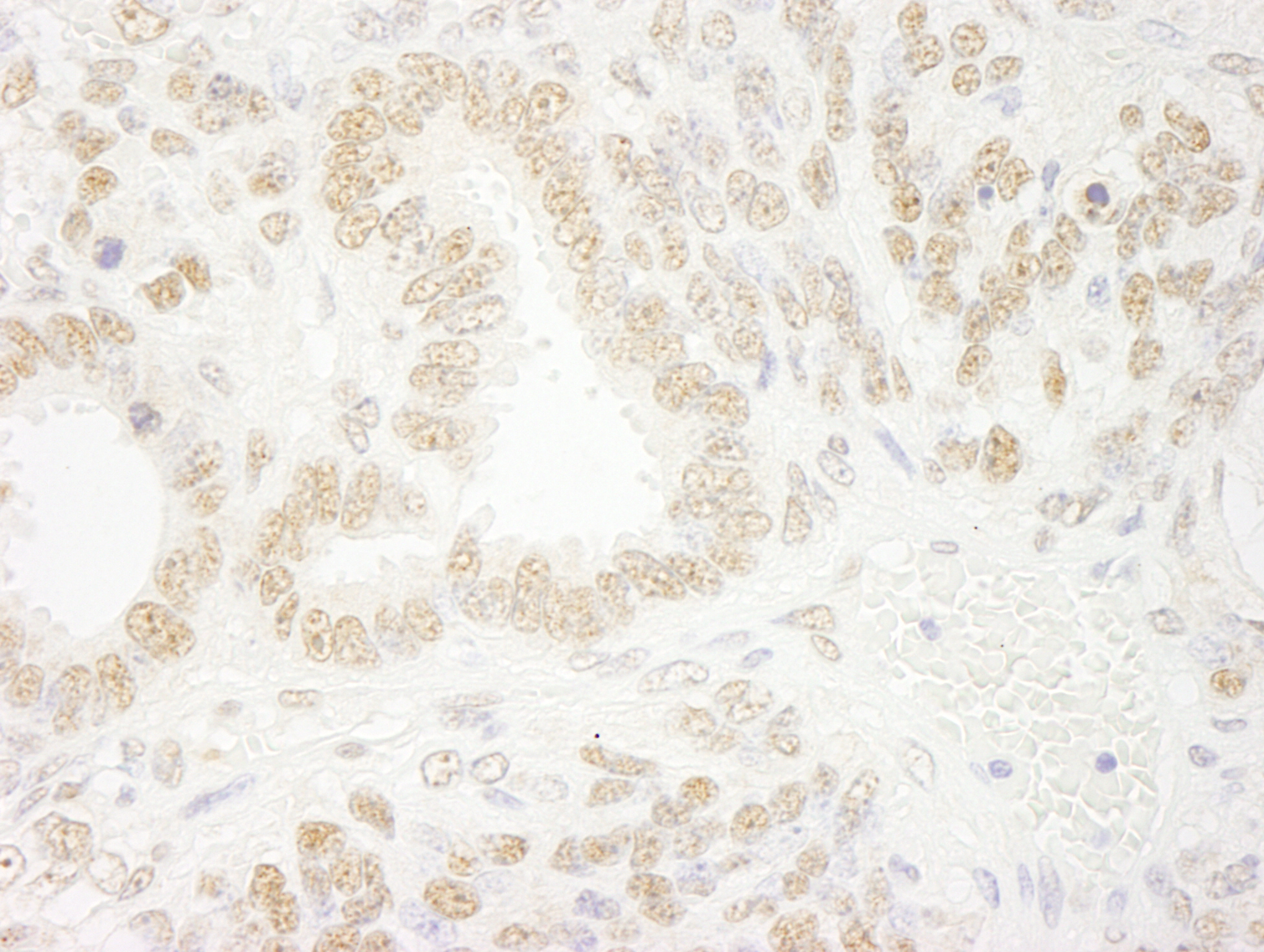 Detection of mouse ZNF198 by immunohistochemistry.