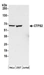 Detection of human CTPS2 by western blot.