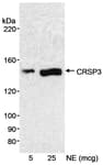 Detection of human CRSP3 by western blot.