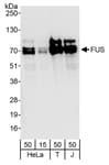 Detection of human FUS by western blot.