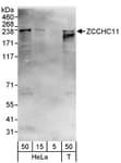 Detection of human ZCCHC11 by western blot.