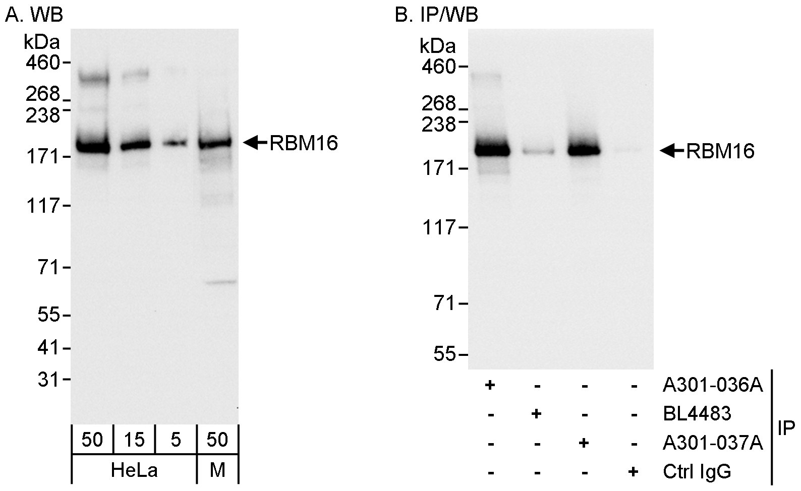 Detection of human and mouse RBM16 by western blot (h&amp;m) and immunoprecipitation (h).