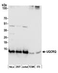 Detection of human and mouse UQCRQ by western blot.