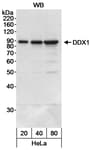 Detection of human DDX1 by western blot.