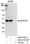 Detection of human MERIT40 by western blot of immunoprecipitates.