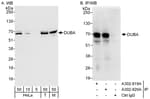 Detection of human and mouse DUBA by western blot (h&amp;m) and immunoprecipitation (h).