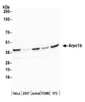 Detection of human and mouse Arpc1b by western blot.