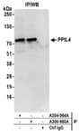 Detection of human PPIL4 by western blot of immunoprecipitates.