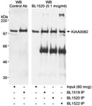 Detection of human KIAA0082 by western blot and immunoprecipitation.