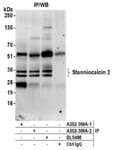Detection of human Stanniocalcin 2 by western blot of immunoprecipitates.
