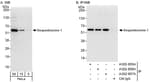 Detection of human Sequestosome-1 by western blot and immunoprecipitation.